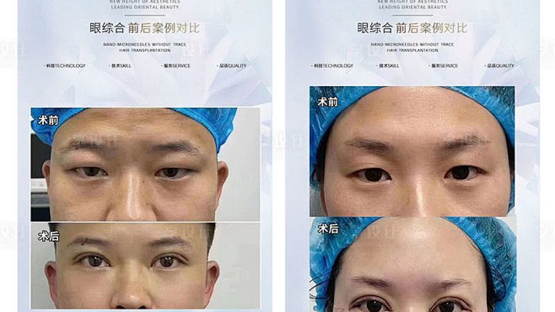 医美咨询师新手需要什么证书