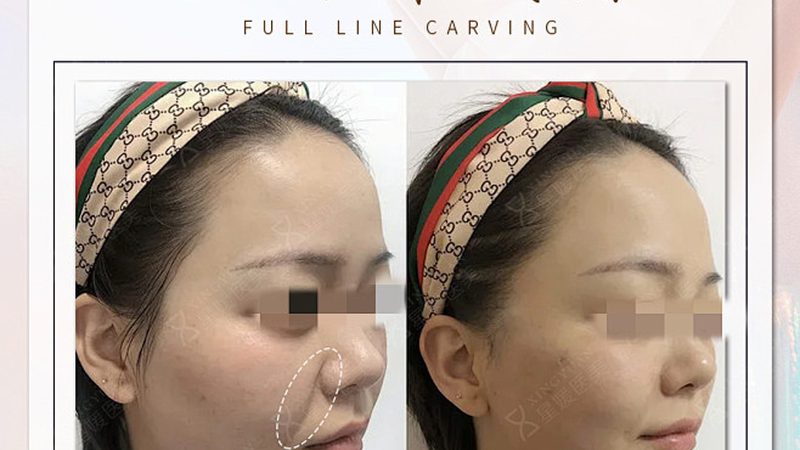 美容院皮肤管理加盟十大品牌排名