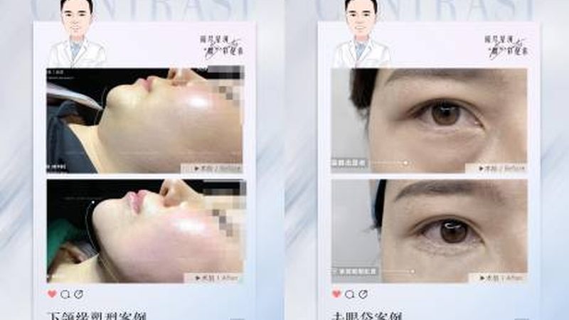 轻医美微整形哪家医院好