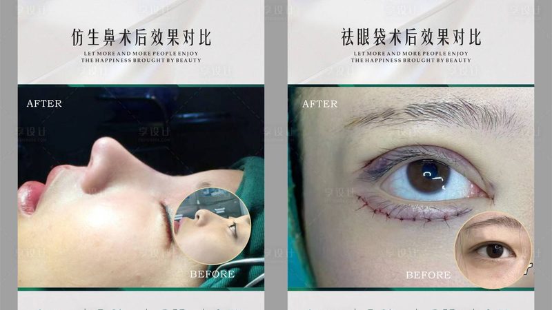 上海家用激光美容仪哪个牌子好