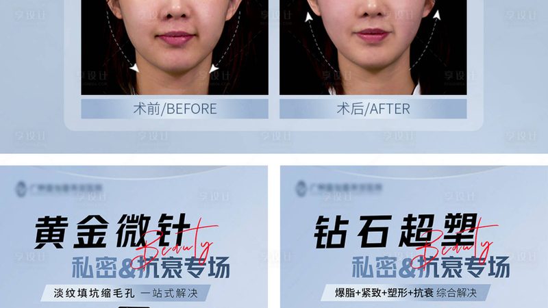 激光美容对孕妇有影响吗