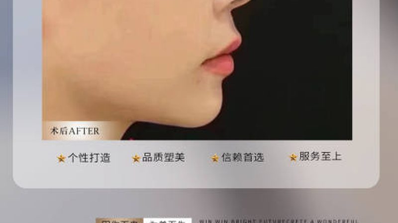 为什么你的眼部整形方案不能照搬网红模板