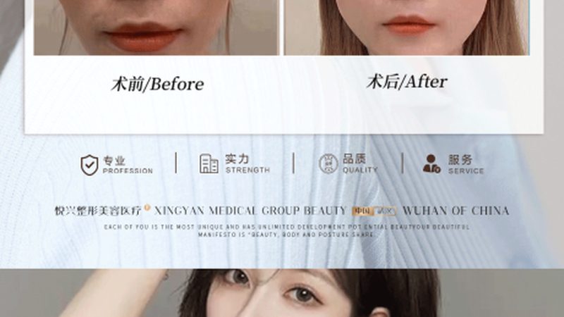 医美咨询师案例分享PPT模板：如何打造专业展示