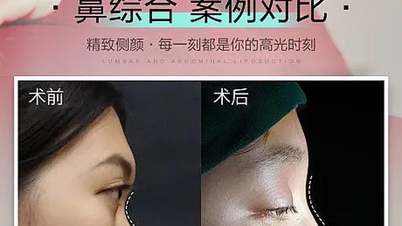 揭秘医美产品批发代理加盟：费用构成与避坑指南