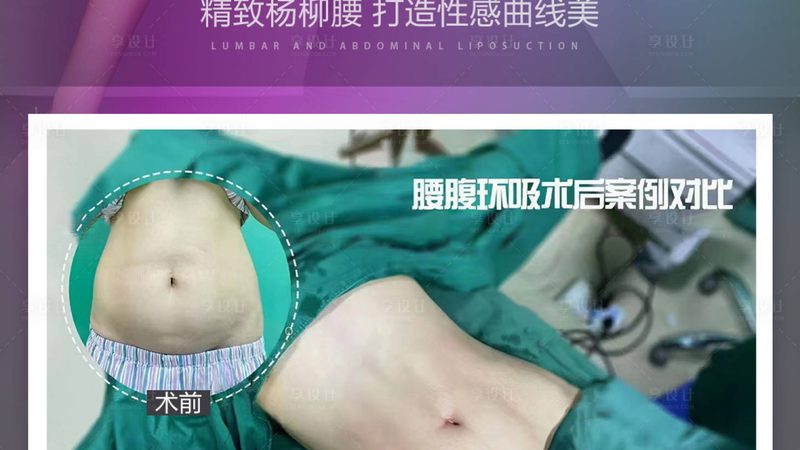 光子嫩肤仪功率参数，如何挑选最适合你的？**