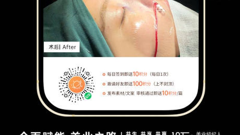 小标题：线头外露的原因