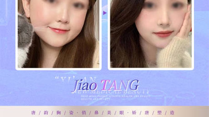 雅萌抗衰美容仪：揭秘其价格背后的科技与价值