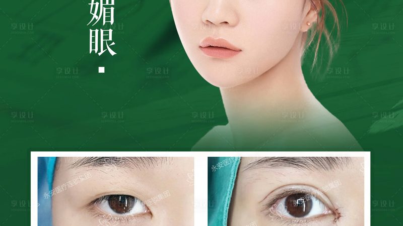 小标题：光子嫩肤后的皮肤状态