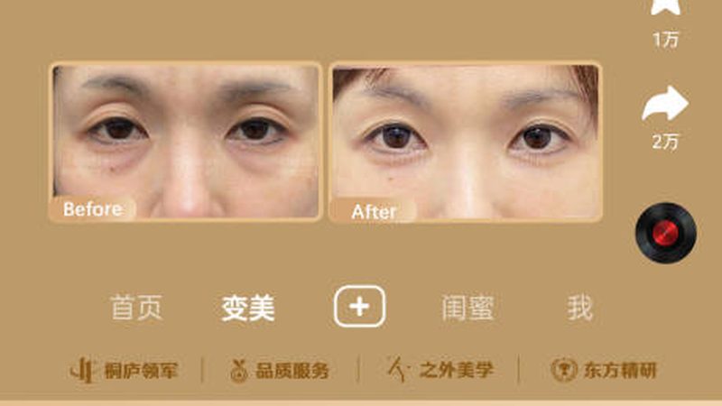 轻医美项目，年龄段的精准匹配之道